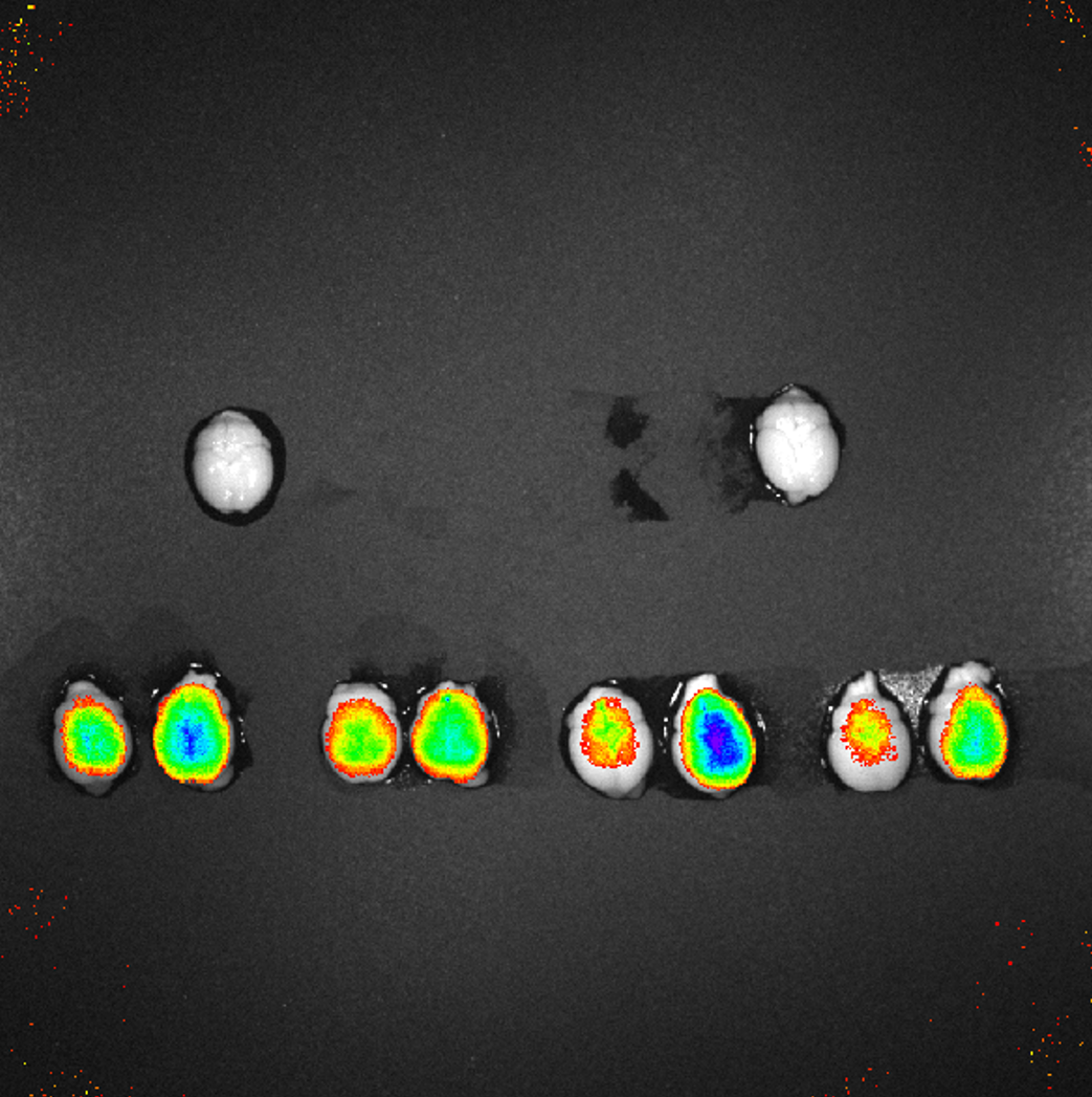 Brain-Targeting Nanobodies
